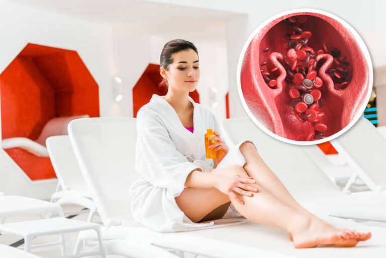 Visszérre is használjunk illóolajokat!