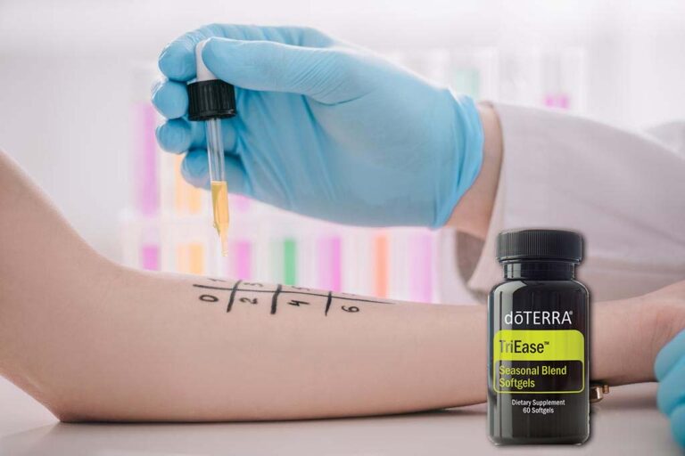 Az allergia kezelése természetesen